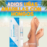 LAPIZ DE UÑAS - MATA HONGOS